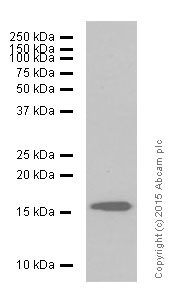 Western blot - Anti-VAMP2 antibody [EPR12790] (ab181869), expandable thumbnail