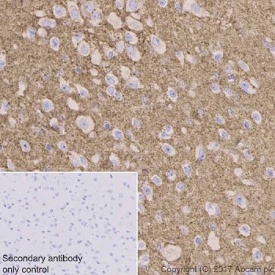 Immunohistochemistry (Formalin/PFA-fixed paraffin-embedded sections) - Anti-VAMP2 antibody [EPR20818] (AB215721)