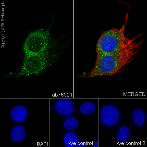 Immunocytochemistry/ Immunofluorescence - Anti-VAMP8/EDB antibody [EP2629Y] (AB76021)