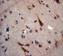 Immunohistochemistry (Formalin/PFA-fixed paraffin-embedded sections) - Anti-VAMP8/EDB antibody [EP2629Y] (AB76021)