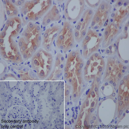 Immunohistochemistry (Formalin/PFA-fixed paraffin-embedded sections) - Anti-VAMP8/EDB antibody [EP2629Y] (AB76021)