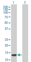 Western blot - VAMP8 / EDB overexpression 293T lysate (whole cell) (AB94103)