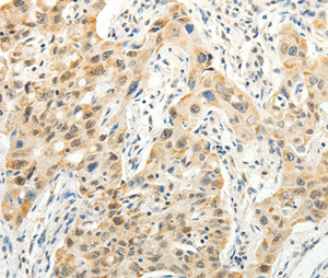 Immunohistochemistry (Formalin/PFA-fixed paraffin-embedded sections) - Anti-VANGL2 antibody - N-terminal (AB198887)