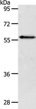 Western blot - Anti-VANGL2 antibody - N-terminal (AB198887)