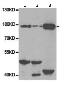 Western blot - Anti-VAP1 antibody (AB187202)
