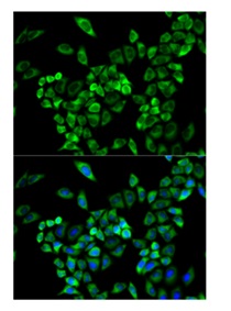 Immunocytochemistry/ Immunofluorescence - Anti-VAP1 antibody (AB196739)
