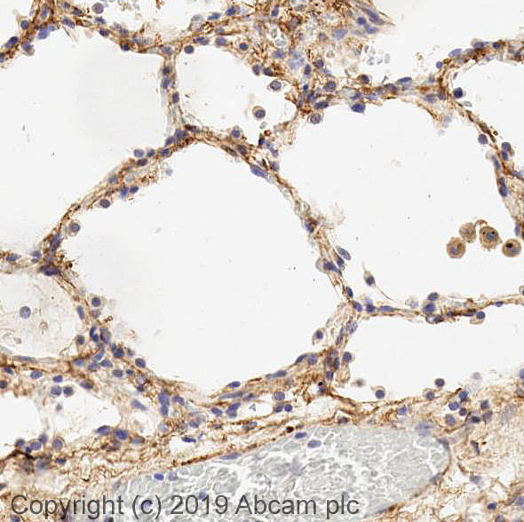Immunohistochemistry (Formalin/PFA-fixed paraffin-embedded sections) - Anti-VAP1 antibody (AB42885)