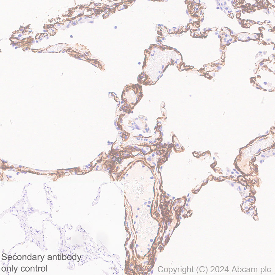 Immunohistochemistry (Formalin/PFA-fixed paraffin-embedded sections) - Anti-VAP1 antibody [EPR28748-59] (AB317620), expandable thumbnail