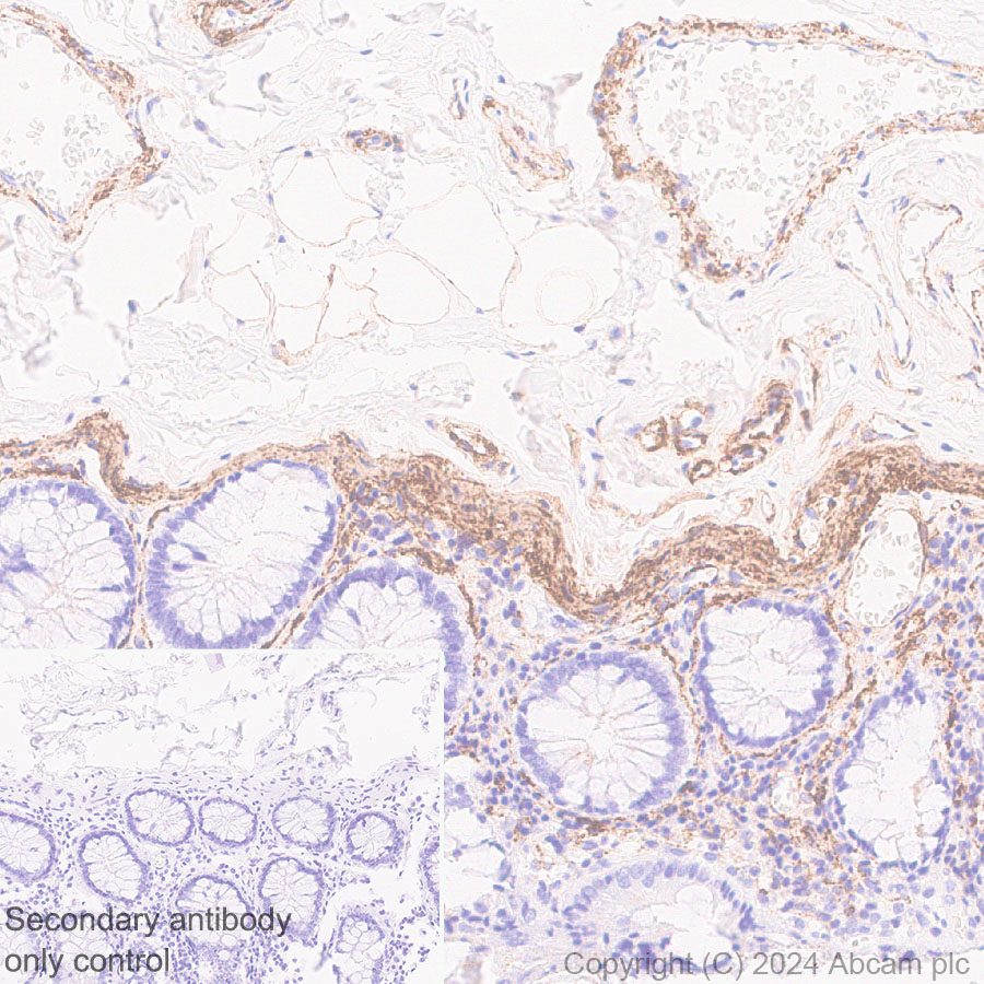 Immunohistochemistry (Formalin/PFA-fixed paraffin-embedded sections) - Anti-VAP1 antibody [EPR28748-59] (AB317620), expandable thumbnail