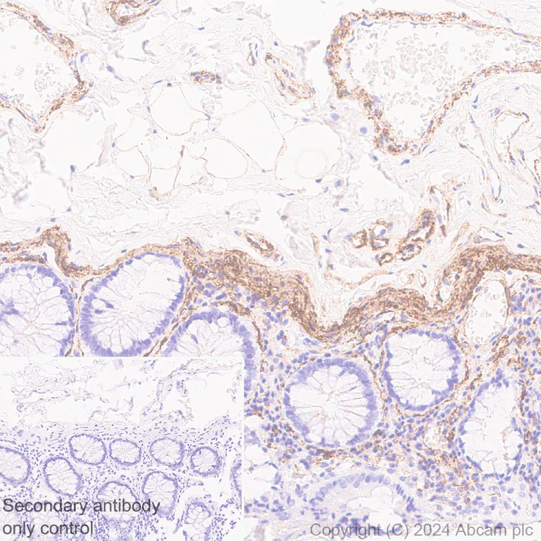 Immunohistochemistry (Formalin/PFA-fixed paraffin-embedded sections) - Anti-VAP1 antibody [EPR28748-59] (AB317620)