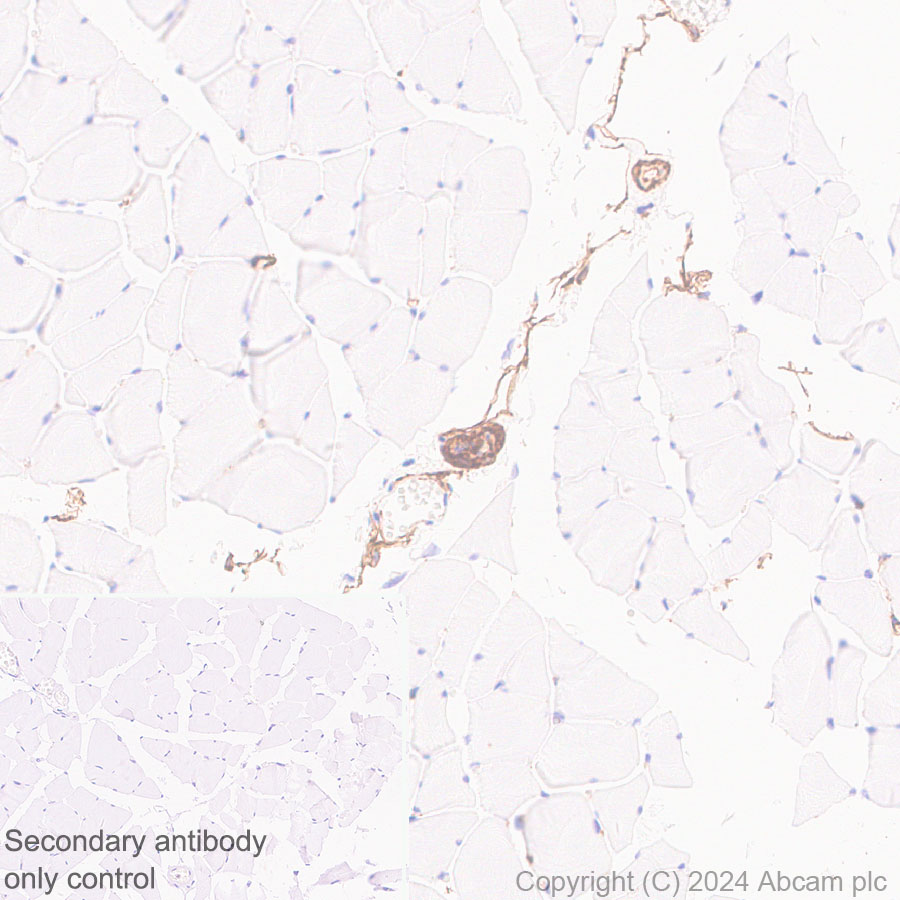 Immunohistochemistry (Formalin/PFA-fixed paraffin-embedded sections) - Anti-VAP1 antibody [EPR28748-59] (AB317620), expandable thumbnail