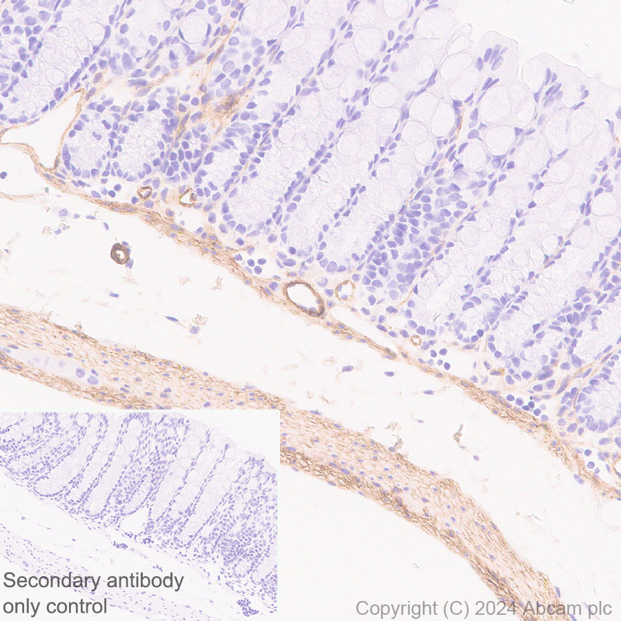 Immunohistochemistry (Formalin/PFA-fixed paraffin-embedded sections) - Anti-VAP1 antibody [EPR28748-59] (AB317620), expandable thumbnail
