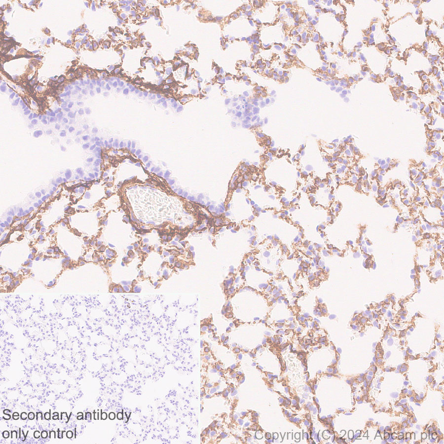 Immunohistochemistry (Formalin/PFA-fixed paraffin-embedded sections) - Anti-VAP1 antibody [EPR28748-59] (AB317620), expandable thumbnail
