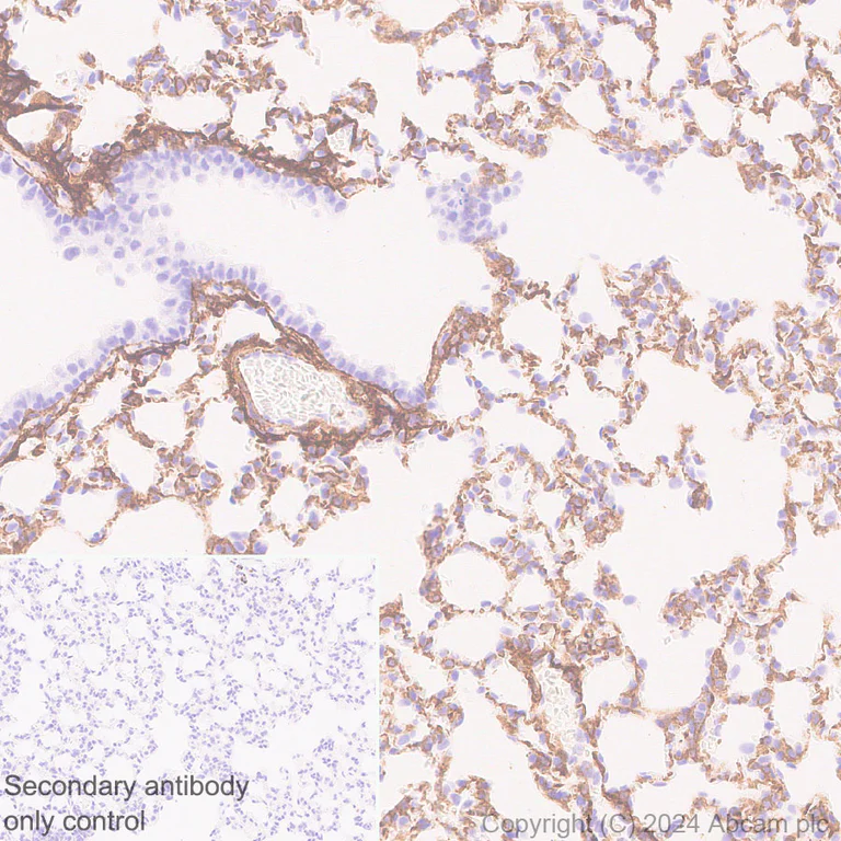 Immunohistochemistry (Formalin/PFA-fixed paraffin-embedded sections) - Anti-VAP1 antibody [EPR28748-59] (AB317620)
