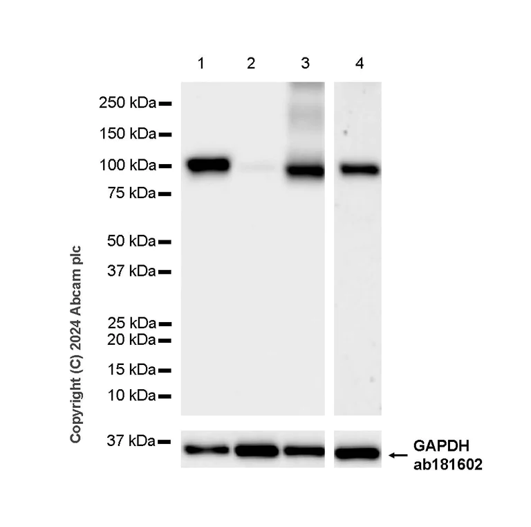 Western blot - Anti-VAP1 antibody [EPR28748-59] (AB317620)