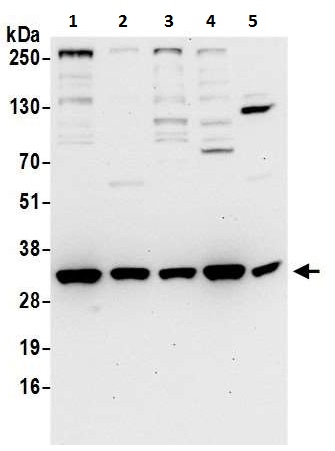 Western blot - Anti-VAPA antibody (AB225890), expandable thumbnail