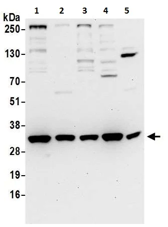 Western blot - Anti-VAPA antibody (AB225890)