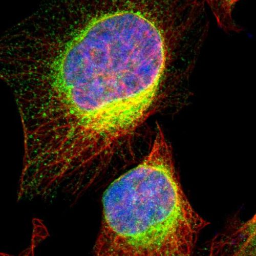 Immunocytochemistry/ Immunofluorescence - Anti-VAPA antibody (AB244312)