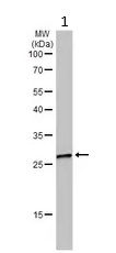 Western blot - Anti-VAPA antibody (AB96584)