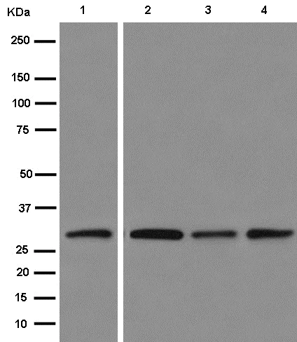 Western blot - Anti-VAPA antibody [EPR13589(B)] - BSA and Azide free (AB250322)