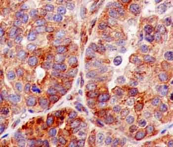Immunohistochemistry (Formalin/PFA-fixed paraffin-embedded sections) - Anti-VAPA antibody [EPR13589(B)] - N-terminal (AB181067)