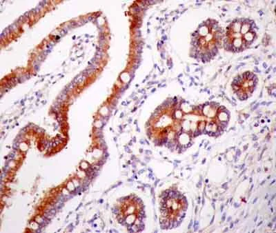 Immunohistochemistry (Formalin/PFA-fixed paraffin-embedded sections) - Anti-VAPA antibody [EPR13589(B)] - N-terminal (AB181067)