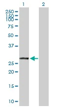 Western blot - Anti-VAPB antibody (AB103638)