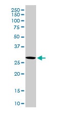Western blot - Anti-VAPB antibody (AB103638)
