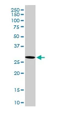 Western blot - Anti-VAPB antibody (AB103638)