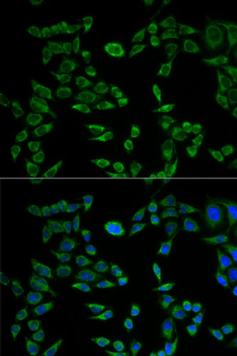 Immunocytochemistry/ Immunofluorescence - Anti-VAPB antibody (AB196487)