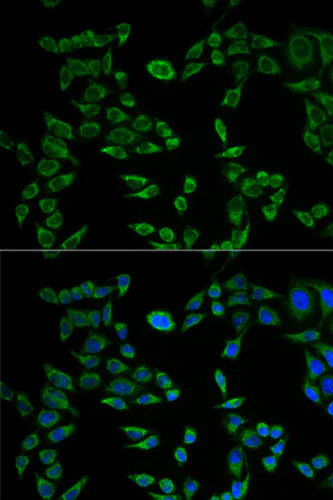 Immunocytochemistry/ Immunofluorescence - Anti-VAPB antibody (AB196487)