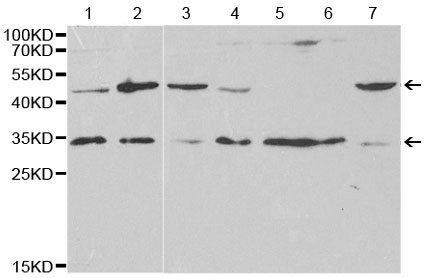 Western blot - Anti-VAPB antibody (AB196487)