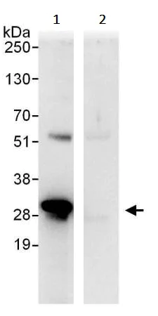 Immunoprecipitation - Anti-VAPB antibody (AB241298)