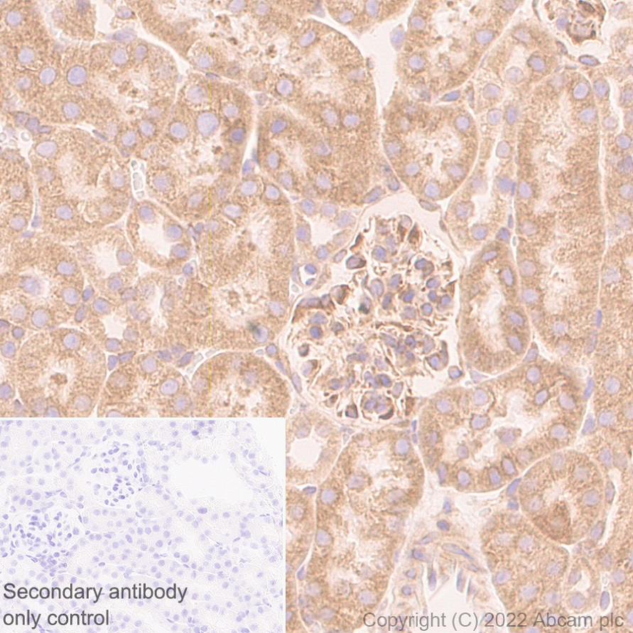 Immunohistochemistry (Formalin/PFA-fixed paraffin-embedded sections) - Anti-VAPB antibody [EPR27026-50] (AB315013), expandable thumbnail