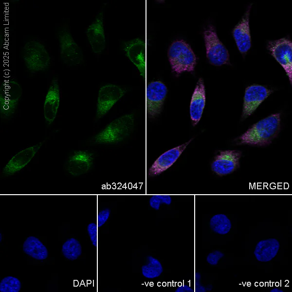 Immunocytochemistry/ Immunofluorescence - Anti-VAPB antibody [EPR27026-59] (AB324047)