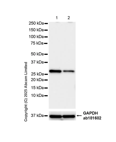 Western blot - Anti-VAPB antibody [EPR27026-59] (AB324047)