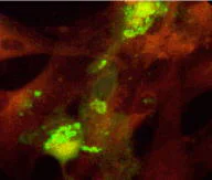 Immunocytochemistry/ Immunofluorescence - Anti-Varicella Zoster Virus gB antibody [10G6] (AB52550)