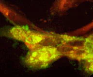 Immunocytochemistry/ Immunofluorescence - Anti-Varicella Zoster Virus gI antibody [8C4] (AB52552)