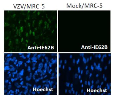 Immunocytochemistry/ Immunofluorescence - Anti-Varicella Zoster Virus IE62 antibody [62B] (AB212015)