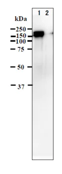 Western blot - Anti-Varicella Zoster Virus IE62 antibody [62B] (AB212015)