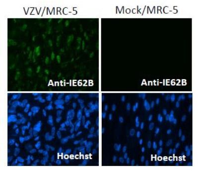 Immunocytochemistry/ Immunofluorescence - Anti-Varicella Zoster Virus IE62 antibody [62B] - BSA and Azide free (AB212015), expandable thumbnail