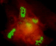 Immunocytochemistry/ Immunofluorescence - Anti-Varicella Zoster Virus IE62 antibody [8B11] (AB52554)