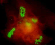 Immunocytochemistry/ Immunofluorescence - Anti-Varicella Zoster Virus IE62 antibody [8B11] (AB52554)