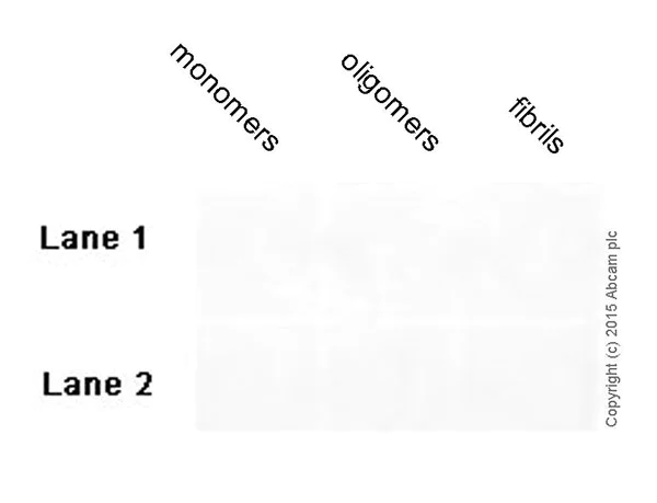 Dot Blot - Anti-vascular Amyloid 1-42 antibody [mOC31] - Conformation-Specific (AB201059)