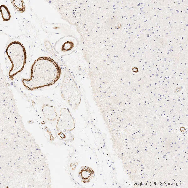 Immunohistochemistry (Formalin/PFA-fixed paraffin-embedded sections) - Anti-vascular Amyloid 1-42 antibody [mOC31] - Conformation-Specific (AB201059)