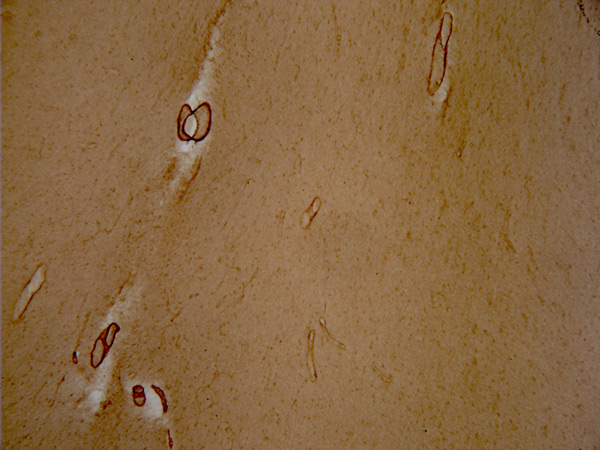 Anti-vascular Amyloid 1-42 antibody [mOC31] - Conformation-Specific