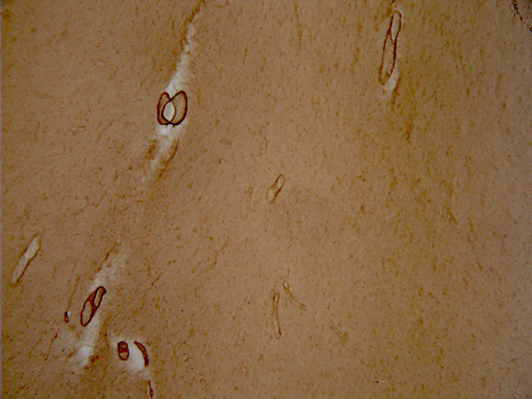 Immunohistochemistry - Free Floating - Anti-vascular Amyloid 1-42 antibody [mOC31] - Conformation-Specific (AB201059)