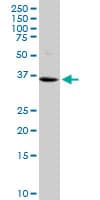 Western blot - Anti-VASH1 antibody [4A3] (AB219790)