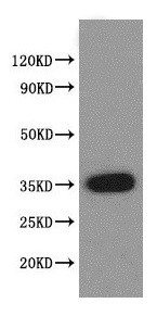 Western blot - Anti-VASH2 antibody (AB224723), expandable thumbnail