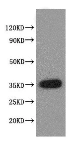 Western blot - Anti-VASH2 antibody (AB224723)
